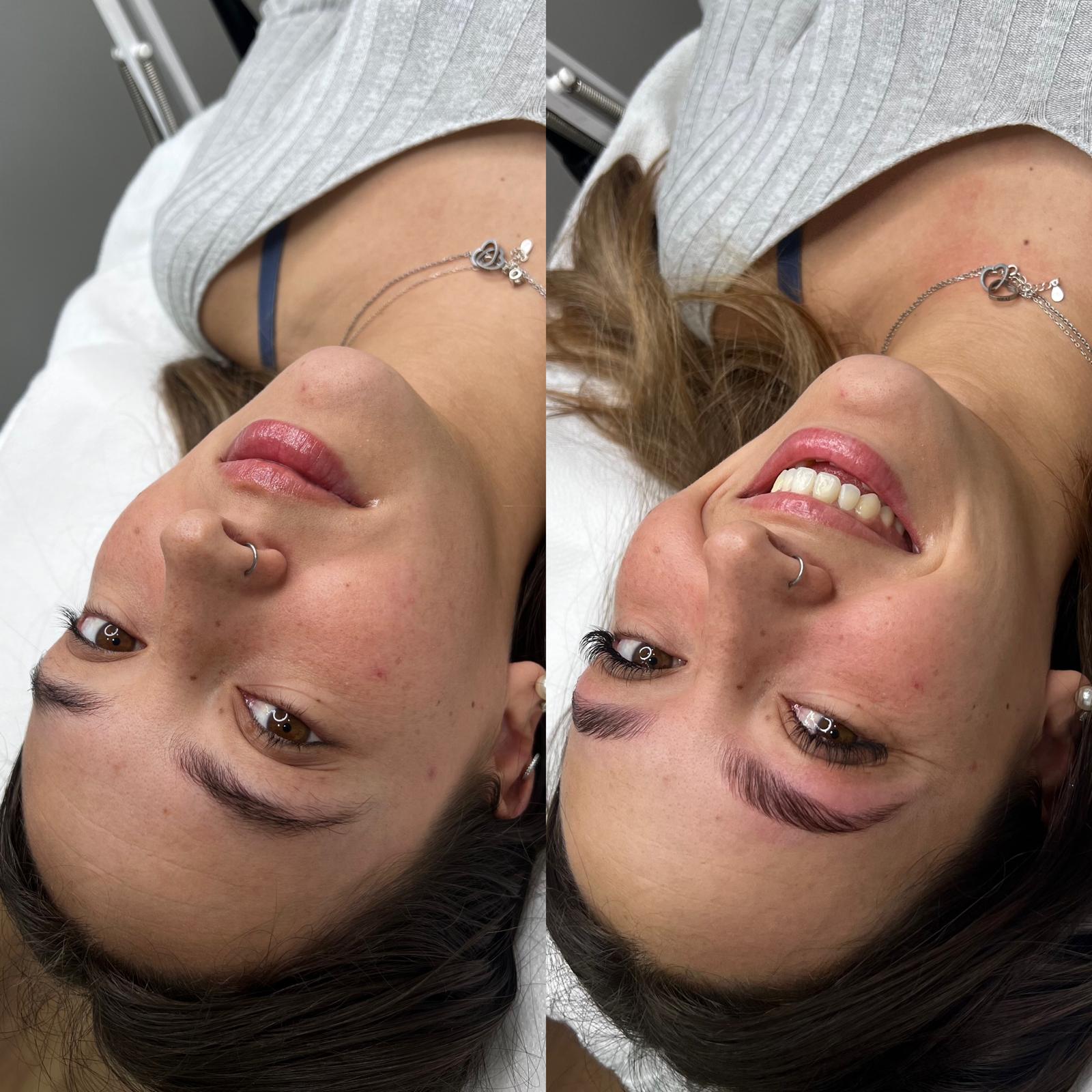 Resultado de micropigmentación de cejas antes y después en Vila-real