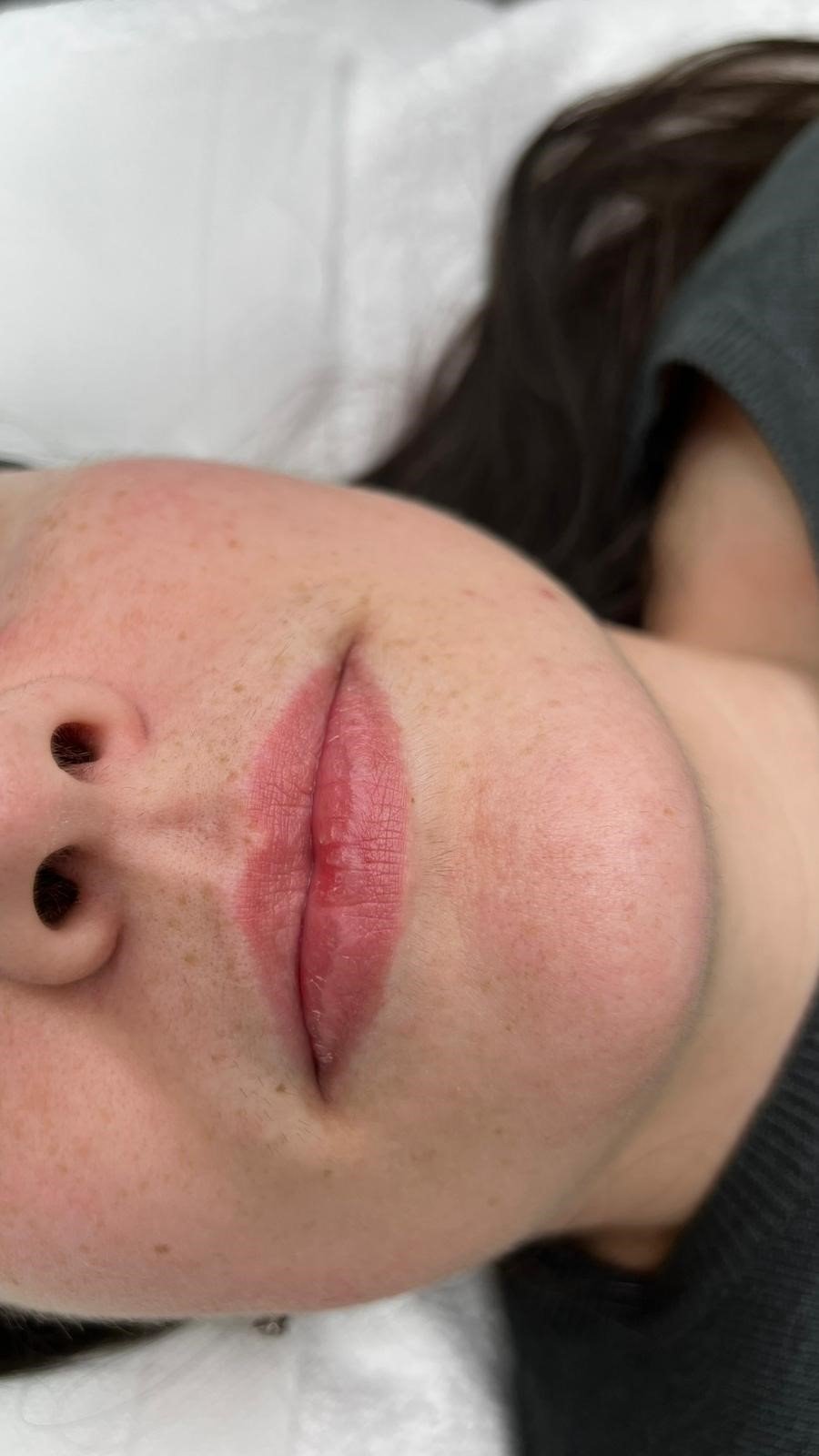 Micropigmentación de labios en MORELA clínica estética, Vila-real
